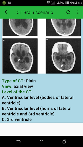 CT Brain - عکس برنامه موبایلی اندروید