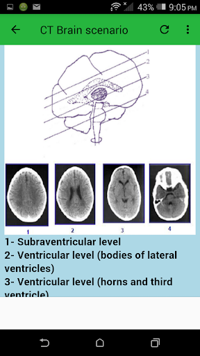 CT Brain - عکس برنامه موبایلی اندروید