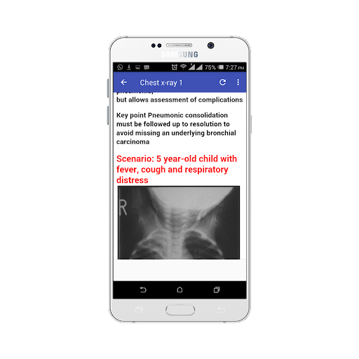 Chest X-ray Easy Guide - عکس برنامه موبایلی اندروید
