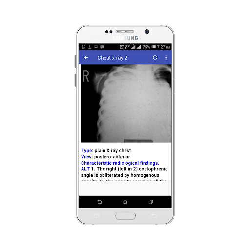 Chest X-ray Easy Guide - عکس برنامه موبایلی اندروید