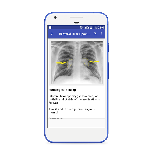 X-Ray Interpretation Guide - Image screenshot of android app