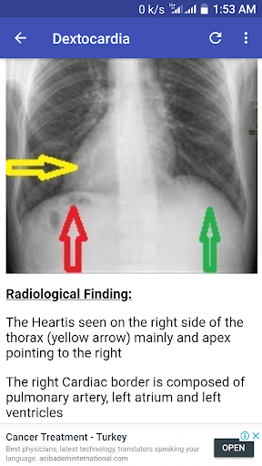 X-Ray Interpretation Guide - عکس برنامه موبایلی اندروید