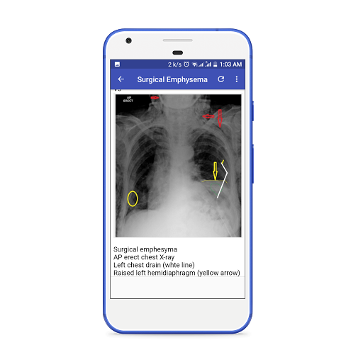 X-Ray Interpretation Guide - عکس برنامه موبایلی اندروید
