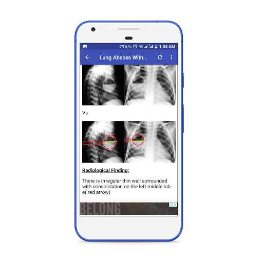 X-Ray Interpretation Guide - عکس برنامه موبایلی اندروید