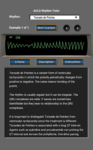 ACLS Rhythm Tutor - Image screenshot of android app