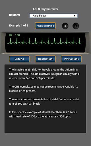 ACLS Rhythm Tutor - Image screenshot of android app