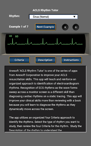 ACLS Rhythm Tutor - Image screenshot of android app