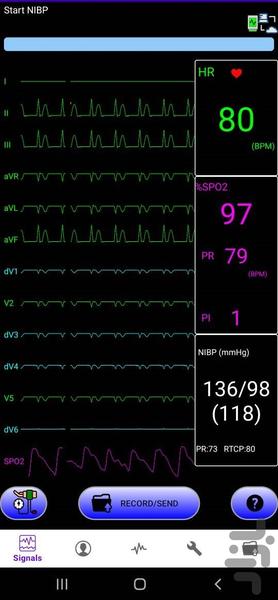 تحلیلگر علائم حیاتی جم اچ 2 - Image screenshot of android app