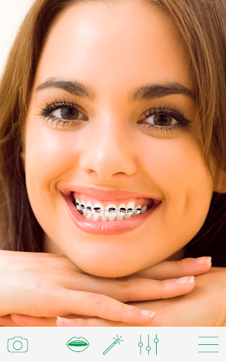 Braces - عکس برنامه موبایلی اندروید