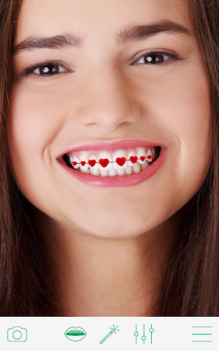 Braces - عکس برنامه موبایلی اندروید