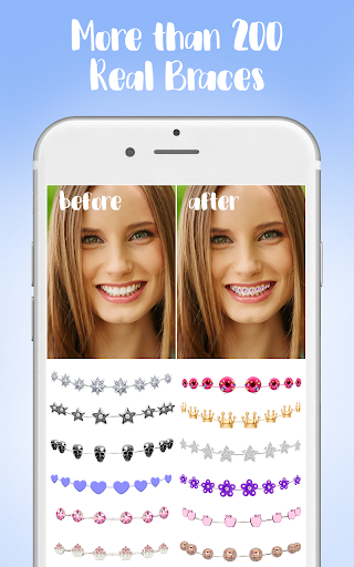 Braces - Image screenshot of android app