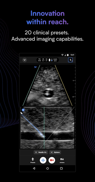 Butterfly iQ — Ultrasound - عکس برنامه موبایلی اندروید