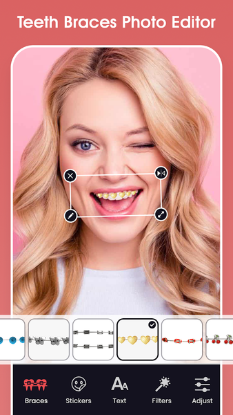 Teeth Braces Photo editor - عکس برنامه موبایلی اندروید