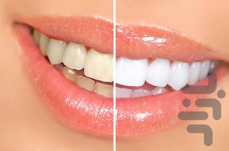 21 روش برای سفید کردن دندان - عکس برنامه موبایلی اندروید