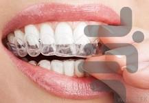 21 روش برای سفید کردن دندان - عکس برنامه موبایلی اندروید