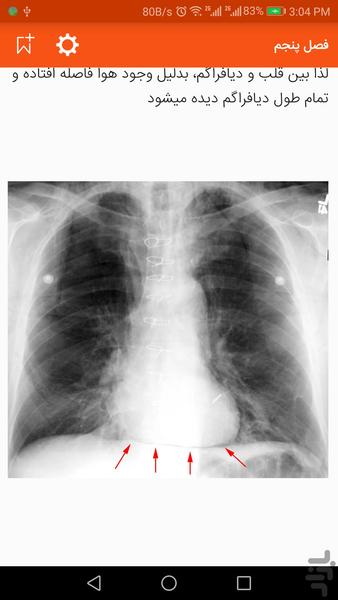 learning CXR book - Image screenshot of android app