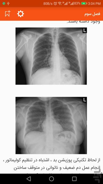 کتاب آموزش CXR - عکس برنامه موبایلی اندروید