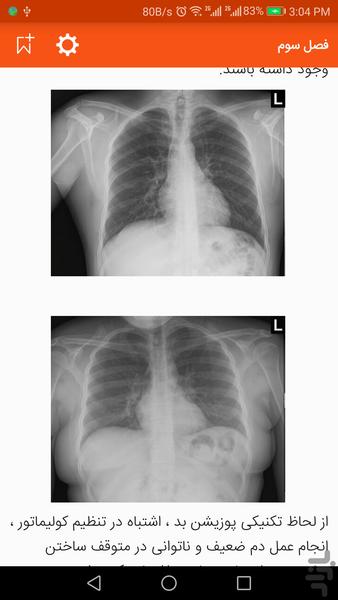 learning CXR book - Image screenshot of android app