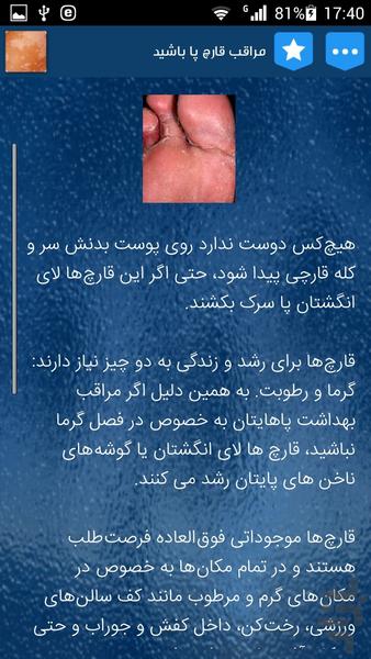 علل و درمان قارچ های پوستی - Image screenshot of android app