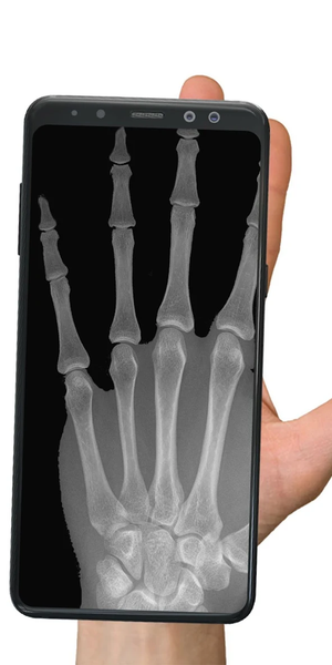 X ray animal photo filter - Image screenshot of android app