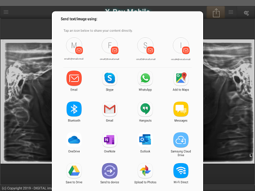 X-Ray Mobile - عکس برنامه موبایلی اندروید