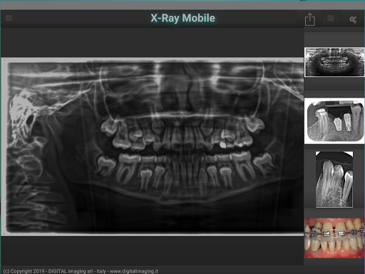 X-Ray Mobile - عکس برنامه موبایلی اندروید