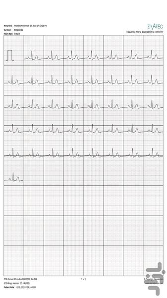 نوار قلب ECGPatch - عکس برنامه موبایلی اندروید