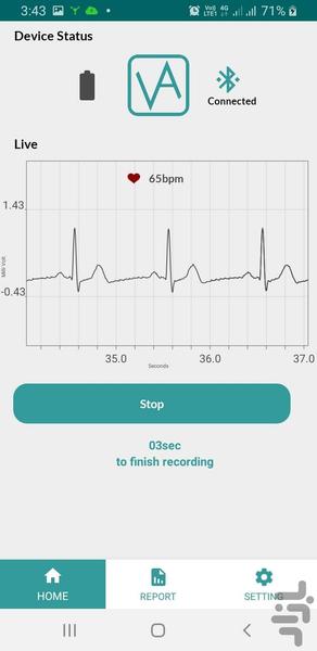 ECGIB (ECG Event Recorder) - Image screenshot of android app