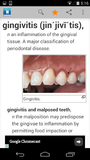 Dental Dictionary by Farlex - Image screenshot of android app