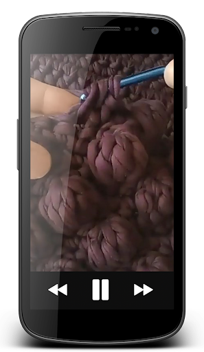 Crochet Pattern - Video Step by Step Offline - عکس برنامه موبایلی اندروید