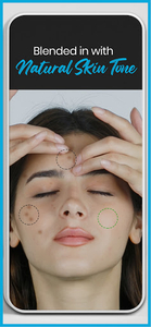 pimple eraser app android