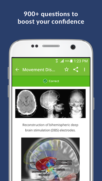 Neurology Exam Review Q&A - Image screenshot of android app