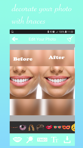Braces Booth Stickers photo ed - Image screenshot of android app