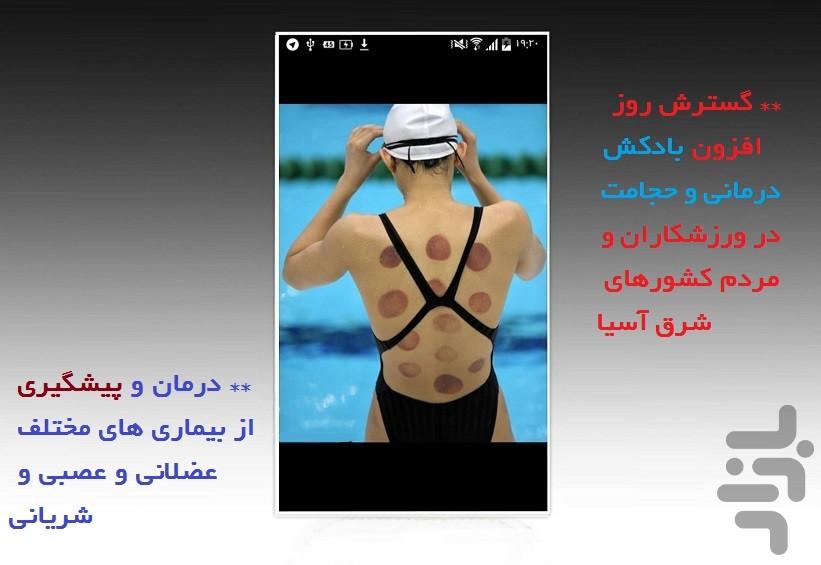 حجامت و بادکش چینی در منزل - Image screenshot of android app