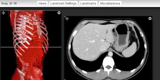 Imaging Anatomy - CT MRI XR US - Image screenshot of android app