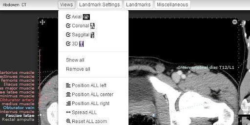 Imaging Anatomy - CT MRI XR US - عکس برنامه موبایلی اندروید