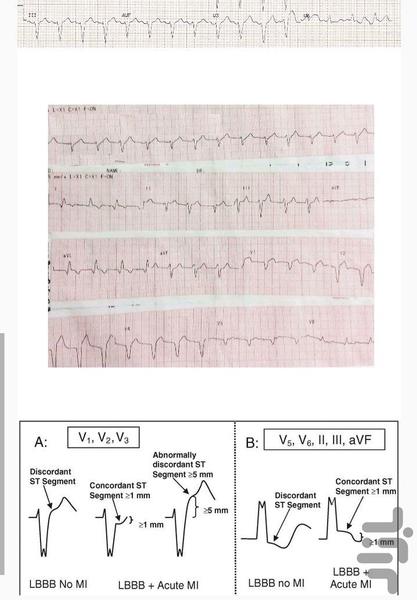 آموزش ECG - عکس برنامه موبایلی اندروید