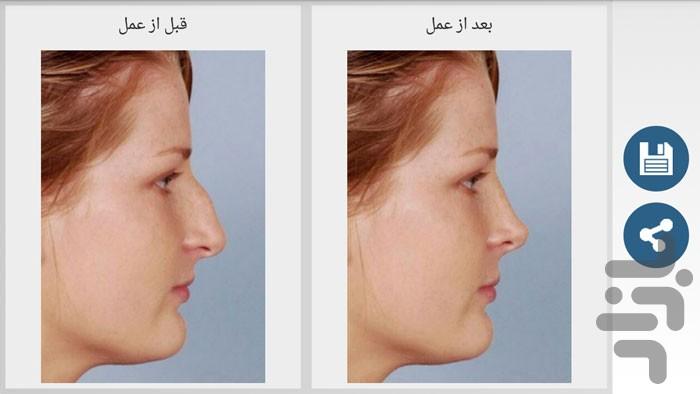 nose cuter - Image screenshot of android app