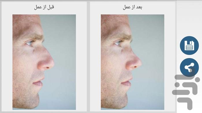 nose cuter - Image screenshot of android app