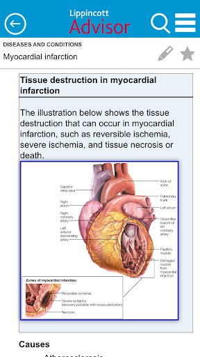 Lippincott Nursing Advisor - Image screenshot of android app