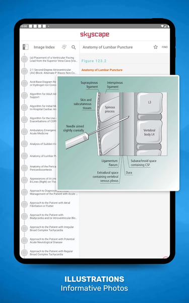 Acute Medicine - Image screenshot of android app