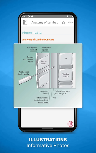 Acute Medicine - Image screenshot of android app