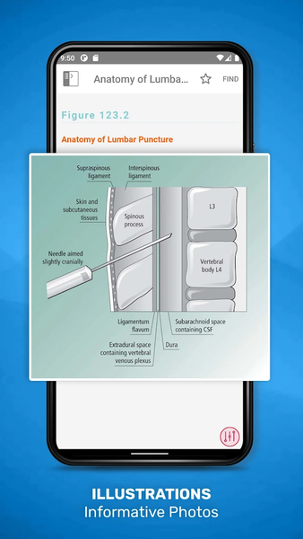 Acute Medicine - Image screenshot of android app