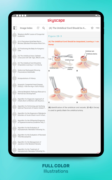 Gomella's Neonatology - Image screenshot of android app