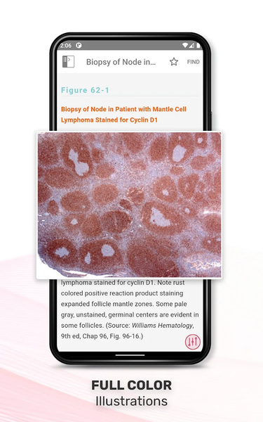Williams Manual of Hematology - عکس برنامه موبایلی اندروید