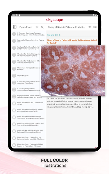 Williams Manual of Hematology - عکس برنامه موبایلی اندروید