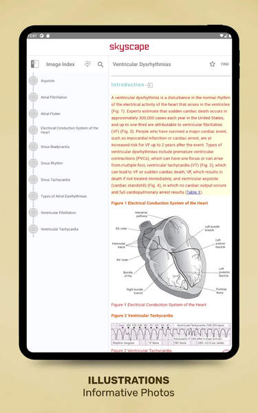 Diseases & Disorders: Nursing - Image screenshot of android app