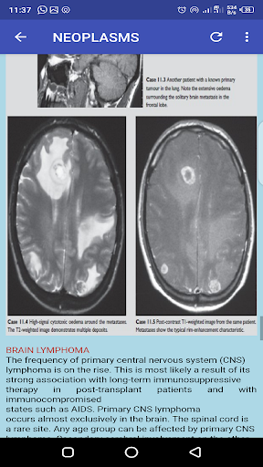 MRI Complete Guide - عکس برنامه موبایلی اندروید