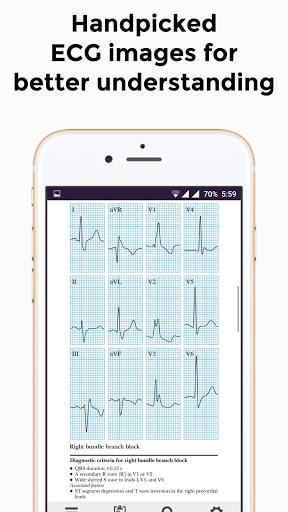 EKG Basics - Learning and interpretation made easy - Image screenshot of android app