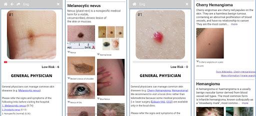 Model Dermatol – Skin Disease - Image screenshot of android app